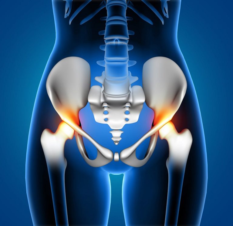 3d female medical figure with spine highlighted pain min 2